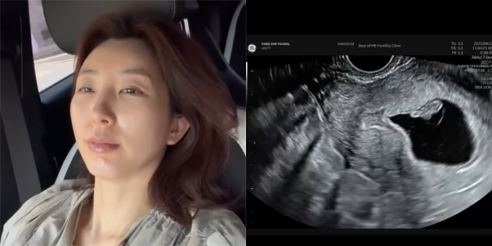 ‘이특 누나’ 박인영, 유산 고백 “아기 별로 보내...지금도 울컥울컥”