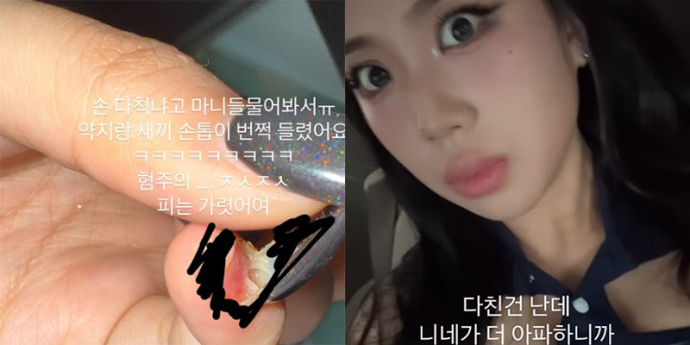 이영지, 연습 중 손톱 부상…“혐 주의, 찔찔 짰음”
