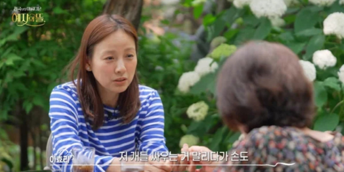 이효리, 아찔한 개물림 사고 고백…“손이 덜렁덜렁”