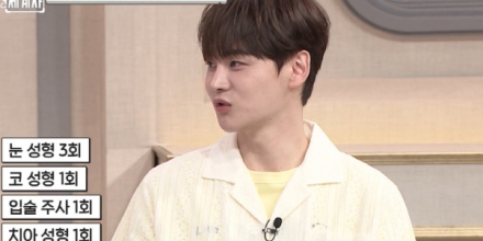 박서진, 억대 성형 부위 고백 (벌거벗은 세계사)