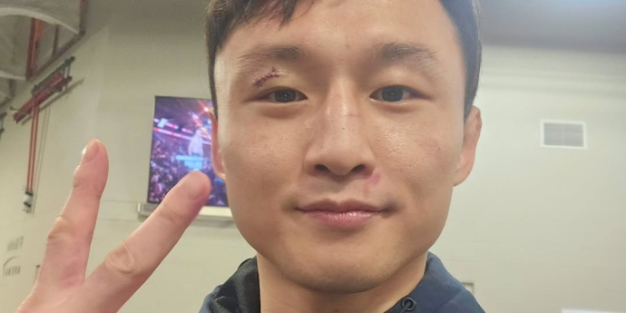 UFC 최두호, 무릎 부상으로 9월 산토스전 취소
