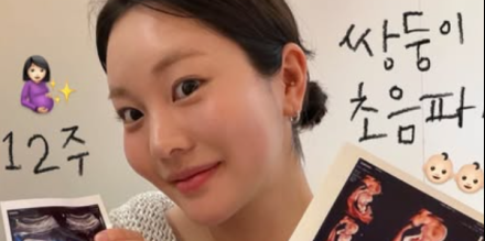 김채연, 쌍둥이 초음파 공개…“성별 결과 기다리는 중” 설렘 가득