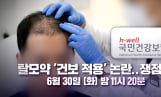 ‘100분토론’ 탈모약 건보 논란, 쟁점은?