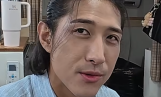 “황재균 맞아?”…장발에 몰라보게 야윈 근황